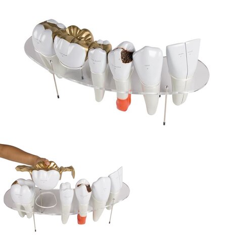 Anatomie model gebit, 10x ware grootte, 7-delig