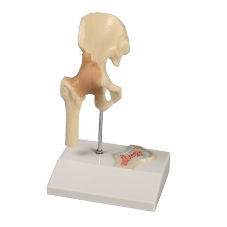 Anatomie model heupgewricht met ligamenten (mini, 12x10x20cm)
