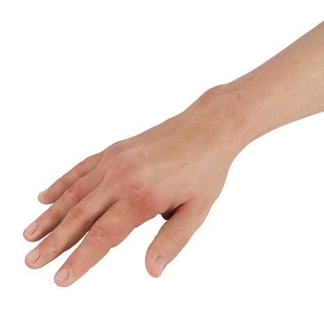 Injectie infuus model arm/hand