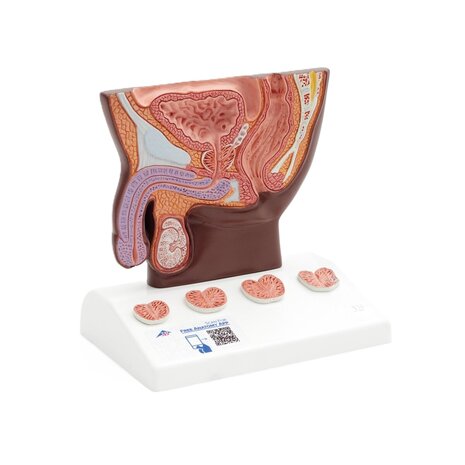 Anatomie model prostaat (donker, 14x10x14 cm)