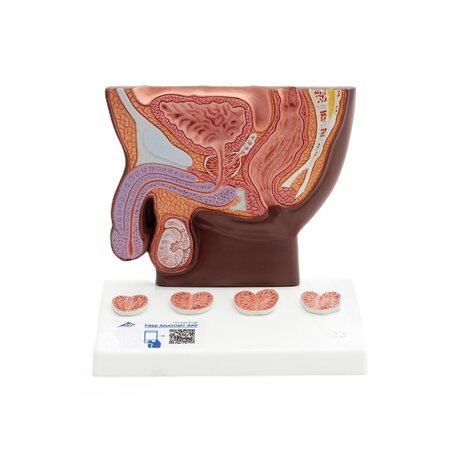 Anatomie model prostaat (donker, 14x10x14 cm)