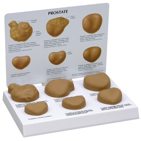 Anatomie model prostaat (22x13x3 cm)