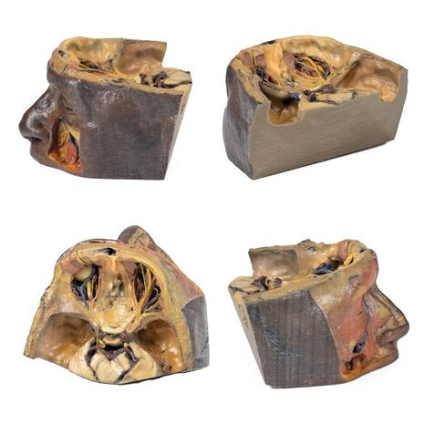 3D Anatomie Serie - bovenste oogkas