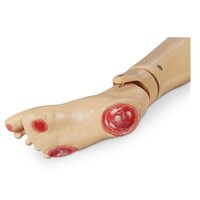 Decubitusvoet (optie voor KERi en GERi)