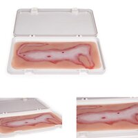 Wondsimulatie - grote brandwond