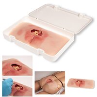 Wondverzorging sacrale decubitus behandeld