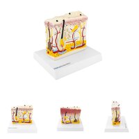 Anatomie model huid met psoriasis