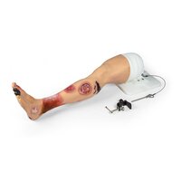 Been met diverse soorten wonden