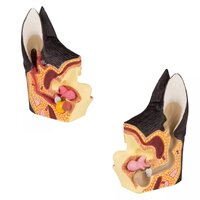 Anatomie model oor hond gezond en ziek, 12x8x5 cm