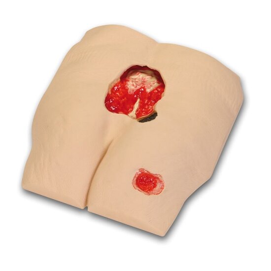 Erler-Zimmer Decubitus behandeling simulator 23x23x12 cm 1 kg