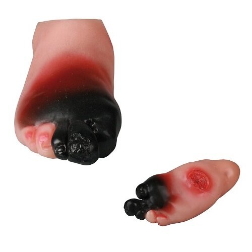 Erler-Zimmer Diabetes voet medische simulator 10x23 cm