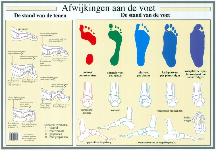 van Baarle Anatomie poster voet en voetafwijkingen Nederlands gelamineerd A2 42x60 cm