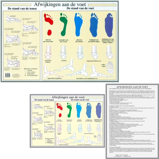 van Baarle Anatomie poster voet en voetafwijkingen Nederlands gelamineerd A2 60x42 cm