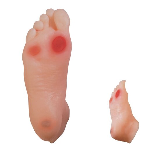 3B Scientific Diabetes voet medische simulator BIOLIKE -materiaal voor patiënteneducatie en training