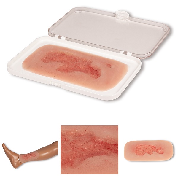 Erler-Zimmer Wondverzorging Veneus Beenulcus Epithelialisatiefase Medische Simulator