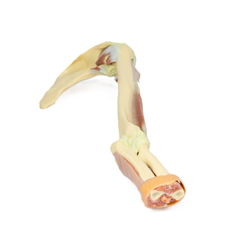 Bovenste extremiteit – biceps, botten en ligamenten
