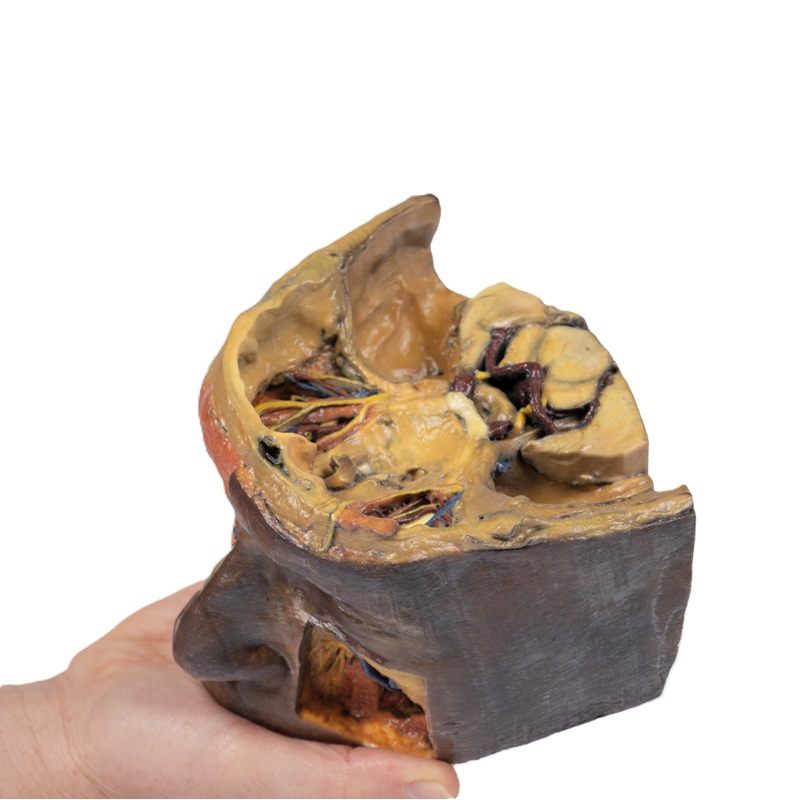 Erler-Zimmer Bovenste oogkas (orbita) Anatomiemodel 3D 