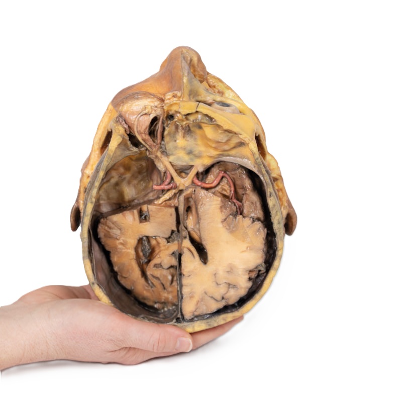 3D Anatomie Serie - dwarsdoorsnede van het hoofd