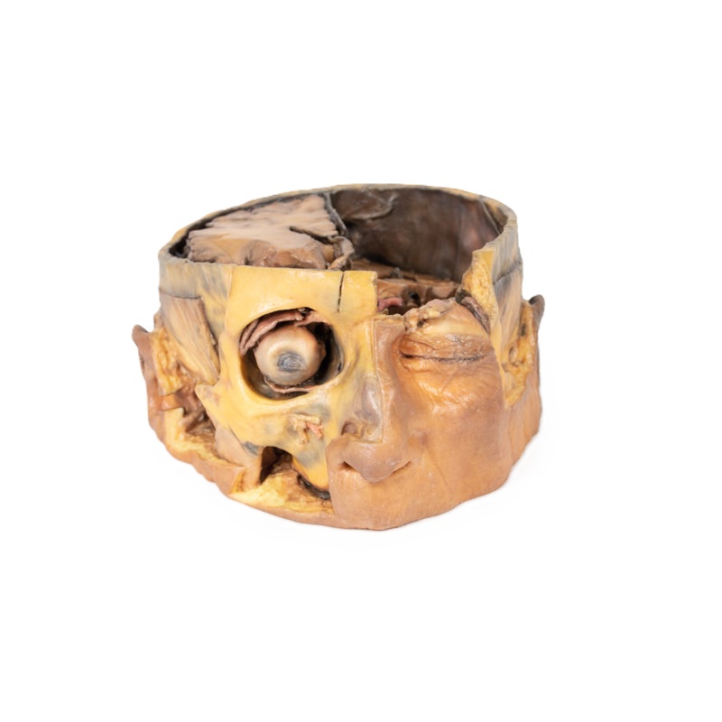 3D Anatomie Serie - dwarsdoorsnede van het hoofd