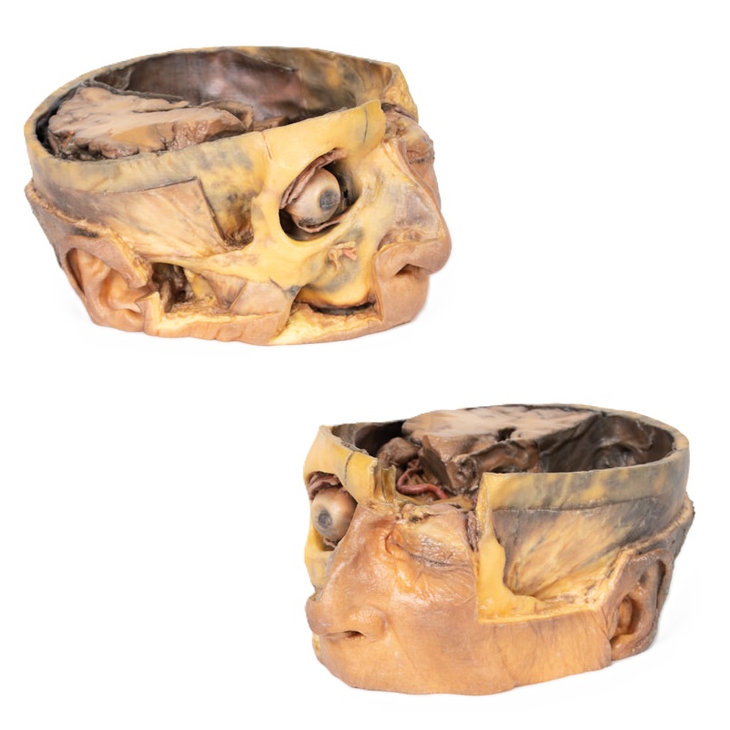 3D Anatomie Serie - dwarsdoorsnede van het hoofd
